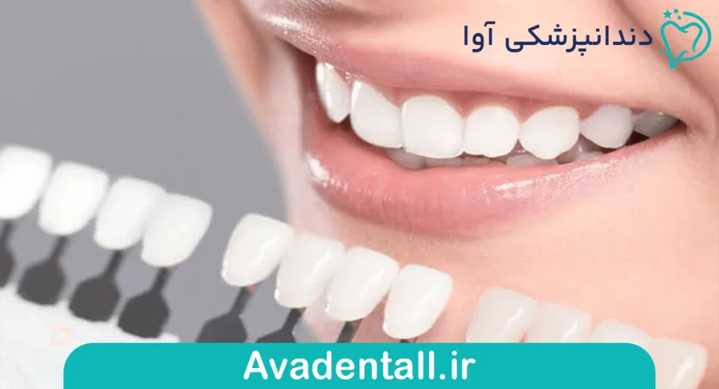 تفاوت در ظرافت و شفافیت