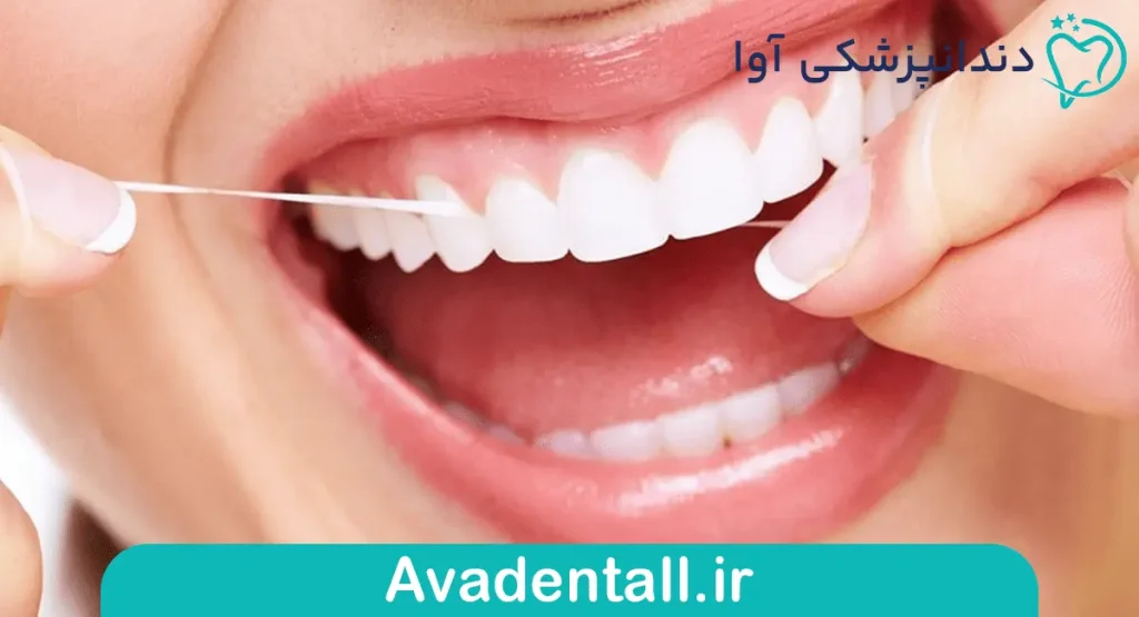 نخ دندان