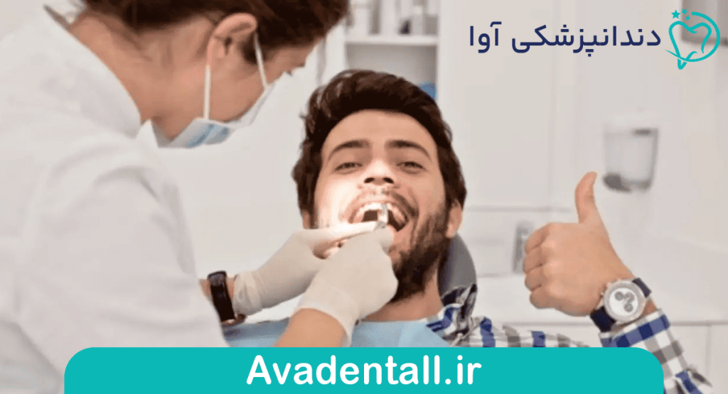 کریزلاین دندان