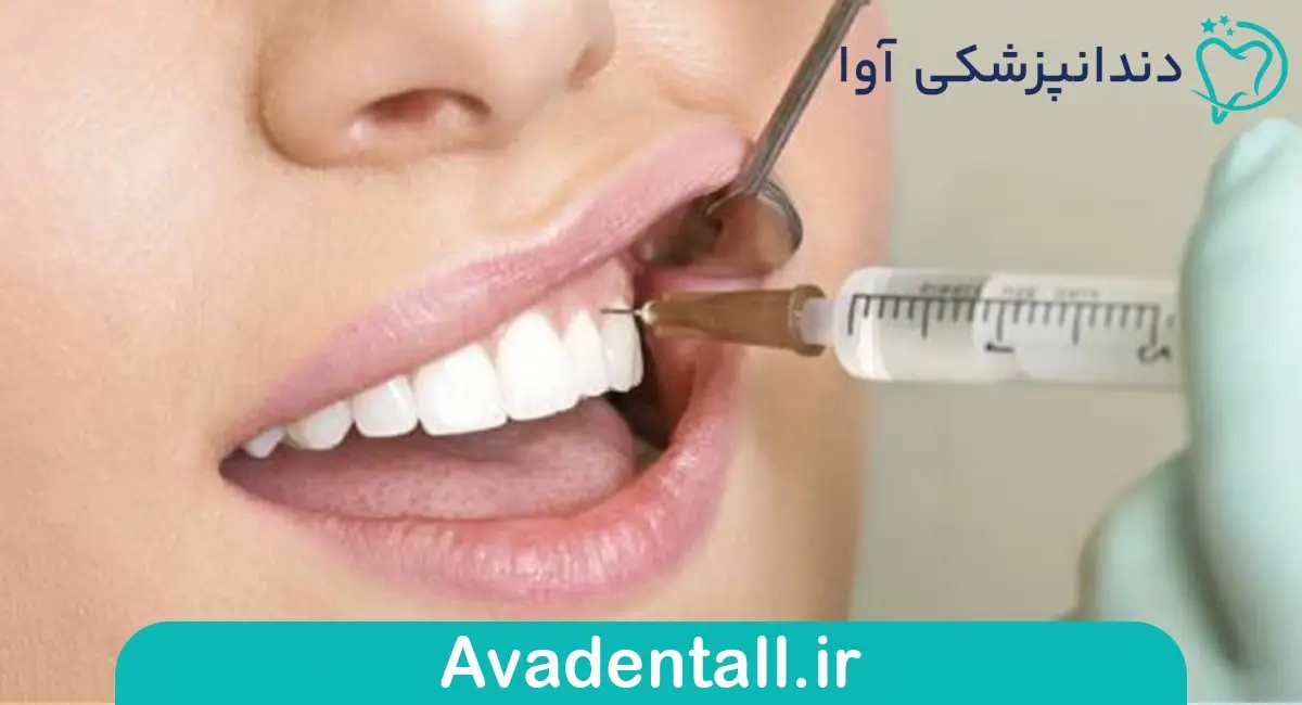 داروی بی حسی