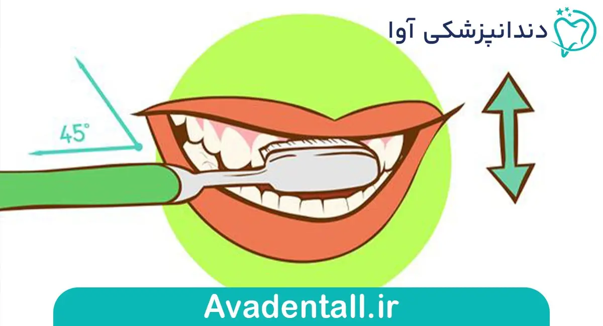 زاویه 45 درجه در مسواک