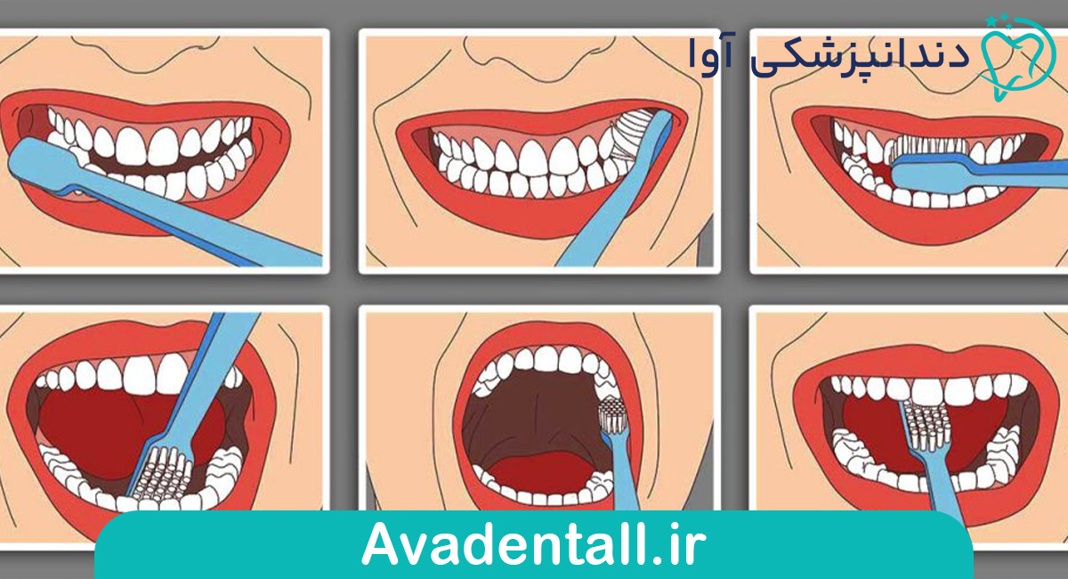 مراحل مسواک زدن