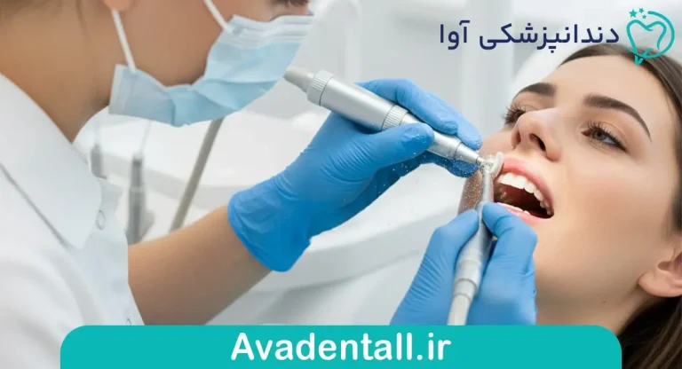 مراقبت های بعد از بروساژ دندان