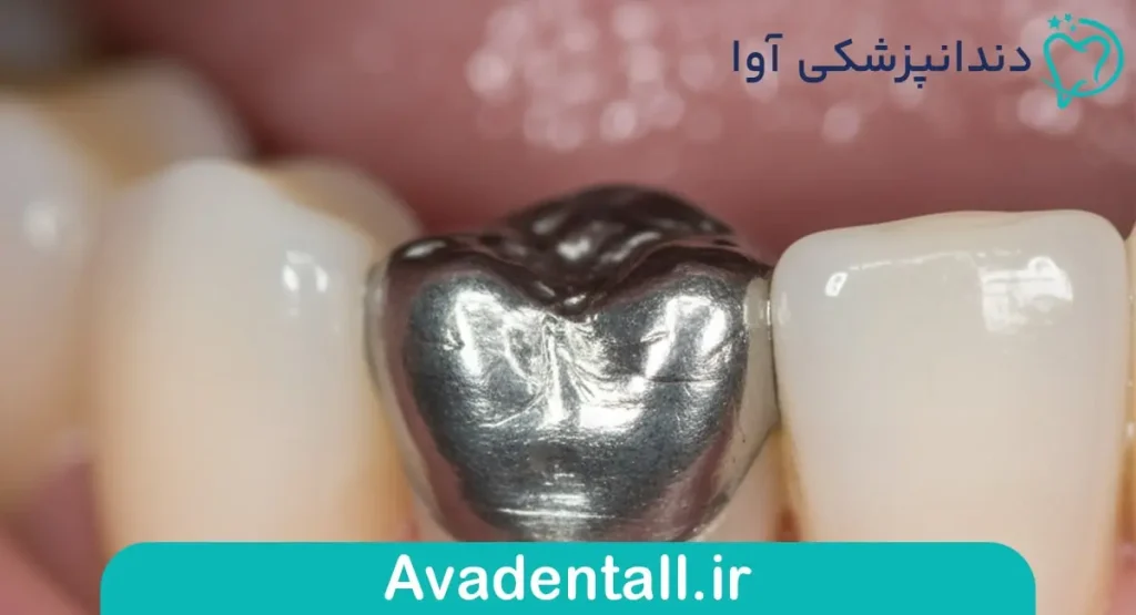مراقبت های بعد از ترمیم