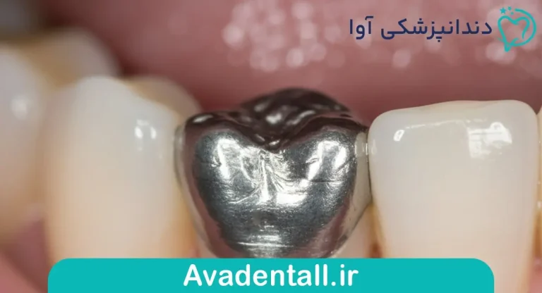 مراقبت های بعد از ترمیم