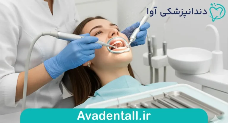 مراقبت های بعد از جرمگیری دندان