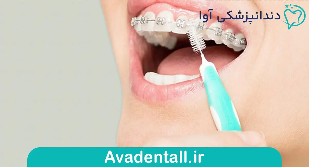 مسواک بین دندانی