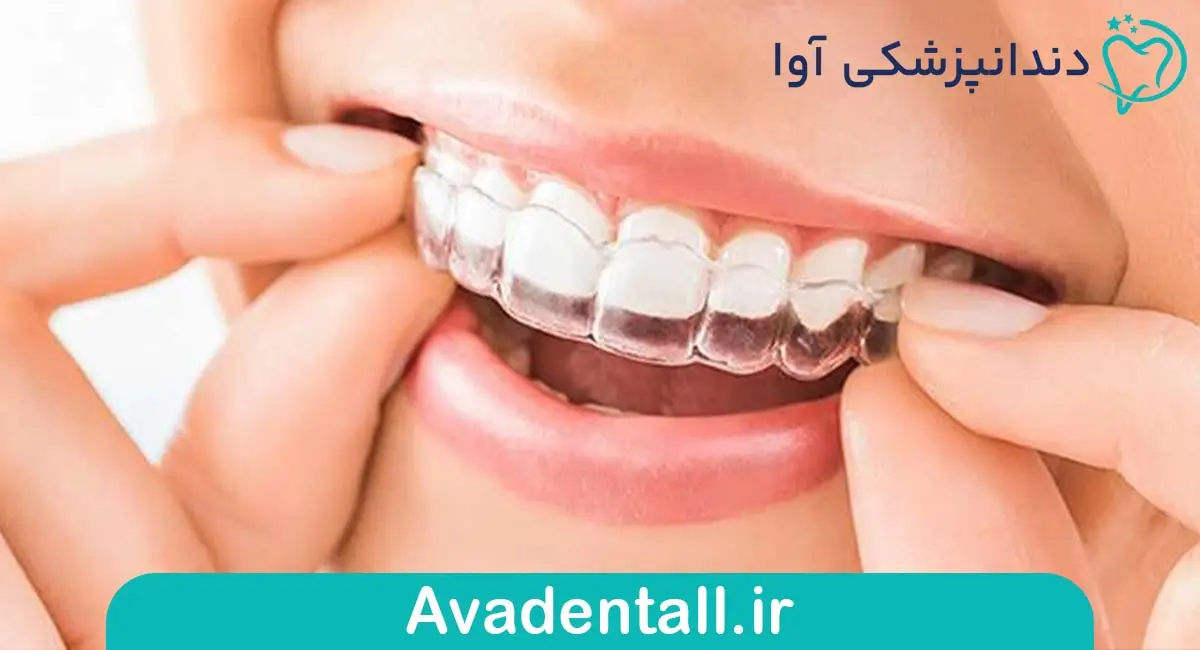 نایت گارد
