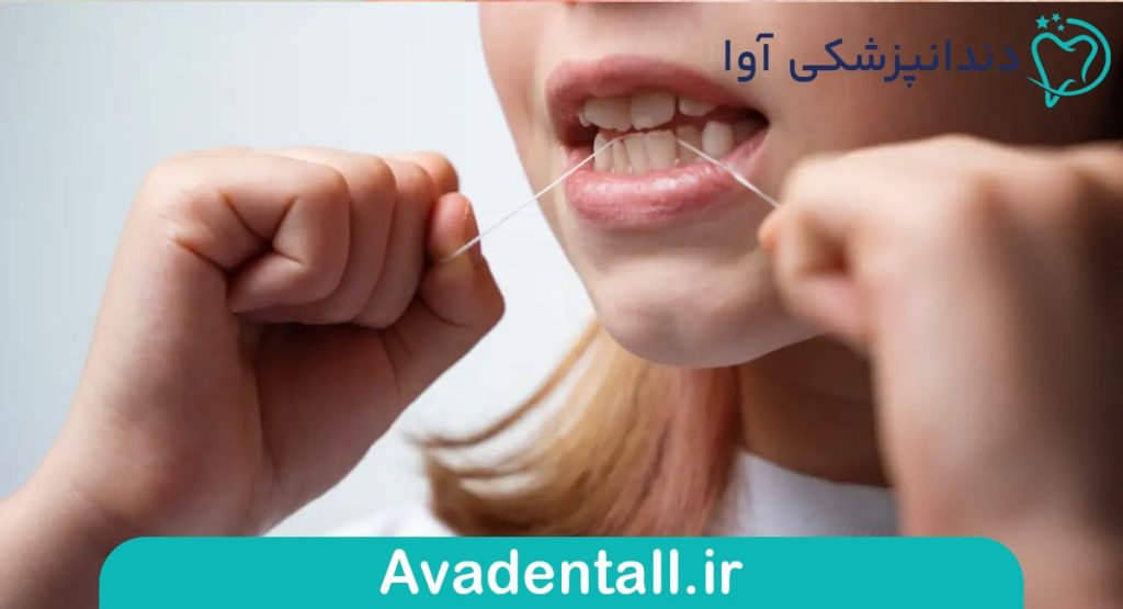 نحوه صحیح استفاده از نخ دندان