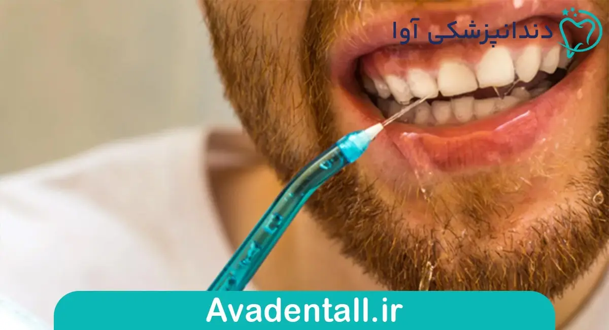 واتر فلاسر