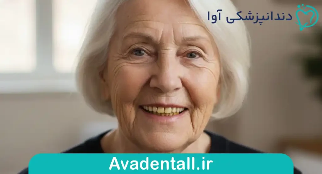 تغییر رنگ دندان ها