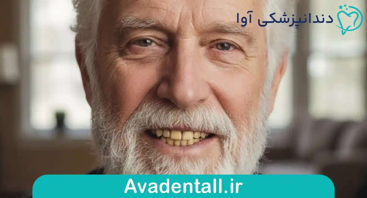 تغییر رنگ دندان ها