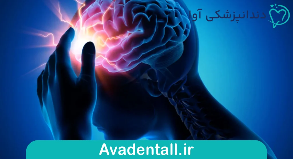 اقدامات حین تشنج