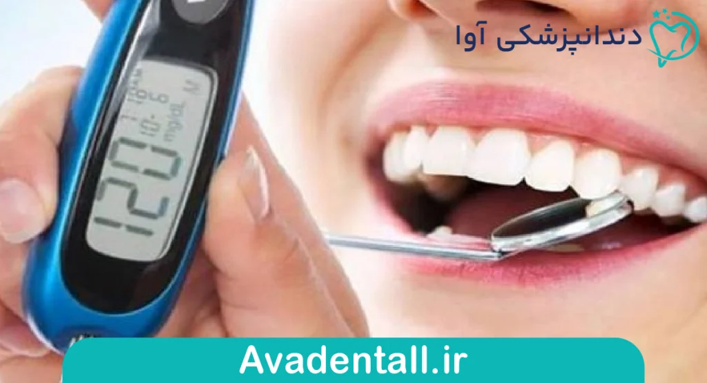  کنترل قند خون کلید موفقیت جراحی دندان