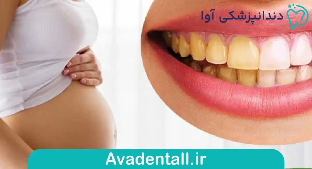 مکانیسم عملکرد بلیچینگ و ترکیبات کلیدی