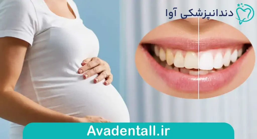 مکانیسم عملکرد بلیچینگ و ترکیبات کلیدی