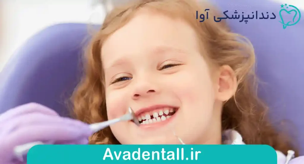 اهمیت جرم گیری وبروساژ دندان کودک