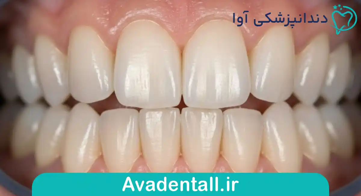 دندان‌های میخ‌شکل